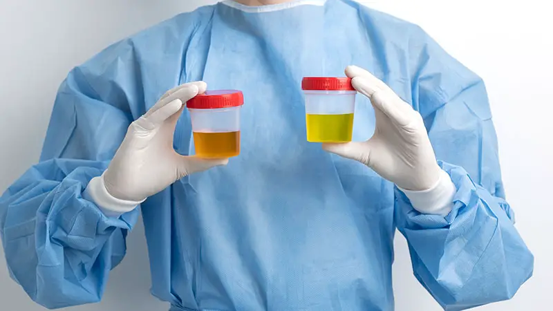 How Long Does Dianabol Stay in Your Urine