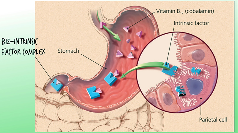Exploring Why Metformin Causes Vitamin B12 Deficiency