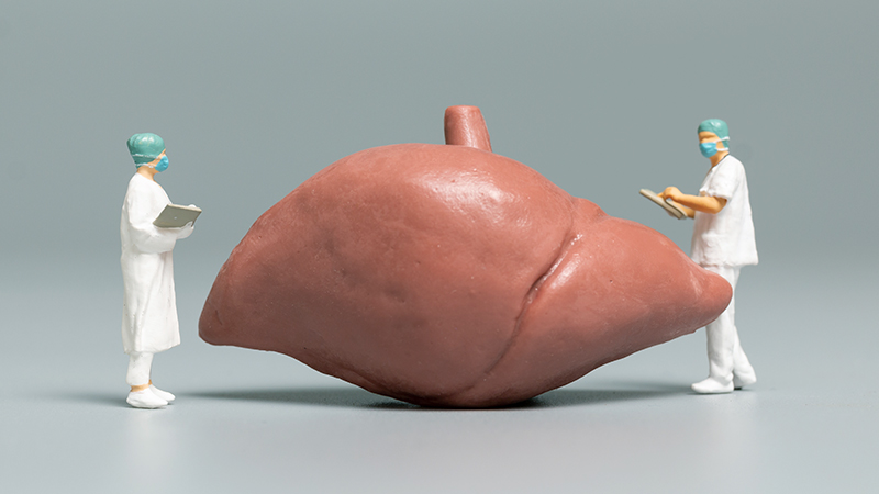 Diagnosing Liver Dumps