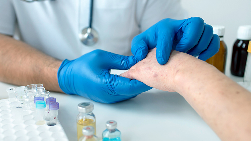 See A Doctor If I Think Creatine Is Causing My Rashes