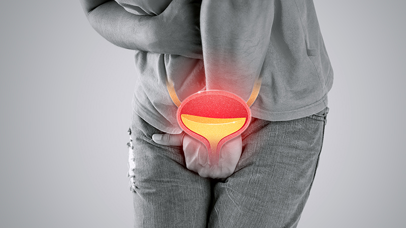 Hydration and Its Impact on Urination
