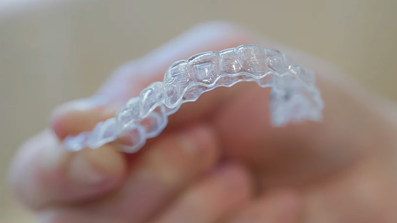 Invisalign and It’s Limitations of Uses