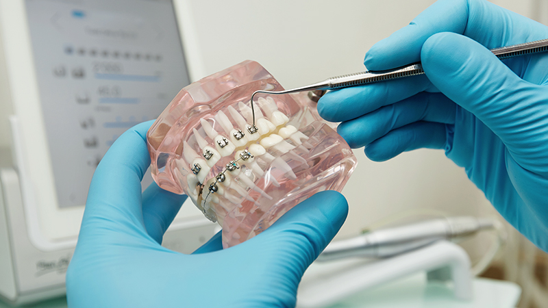 Orthodontic Needs Beyond Alignment