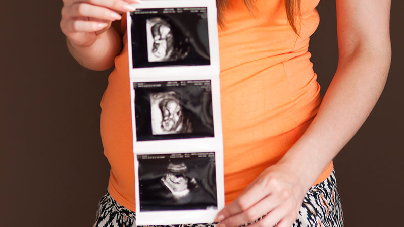 Maternal Age