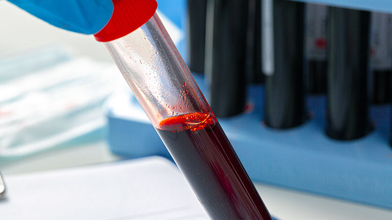 Blood Tests