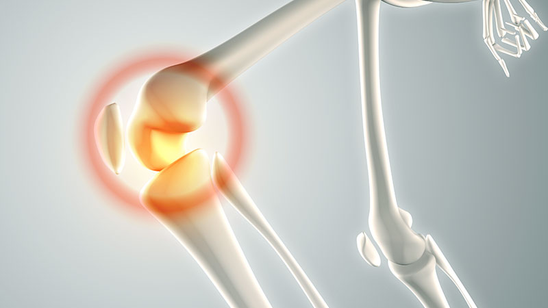 Bone Health and Osteoporosis Prevention