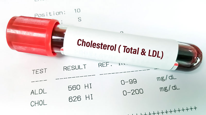 High Cholesterol Levels