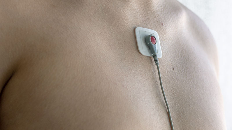 Holter Monitor