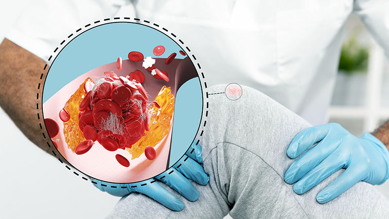 Management of Clostridium difficile Infections