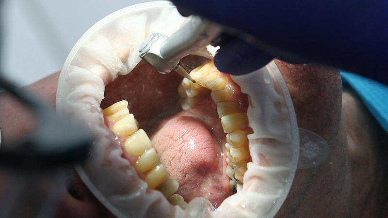 Promotes Dental Health