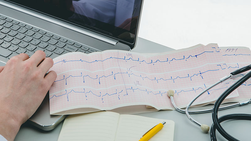 Rapid Heart Rate