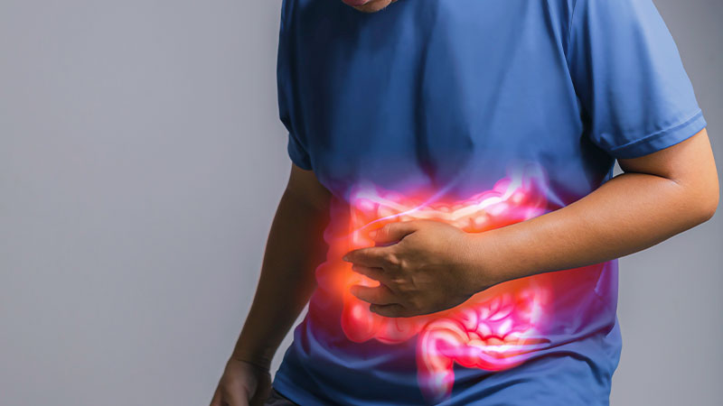 Support for Inflammatory Bowel Disease
