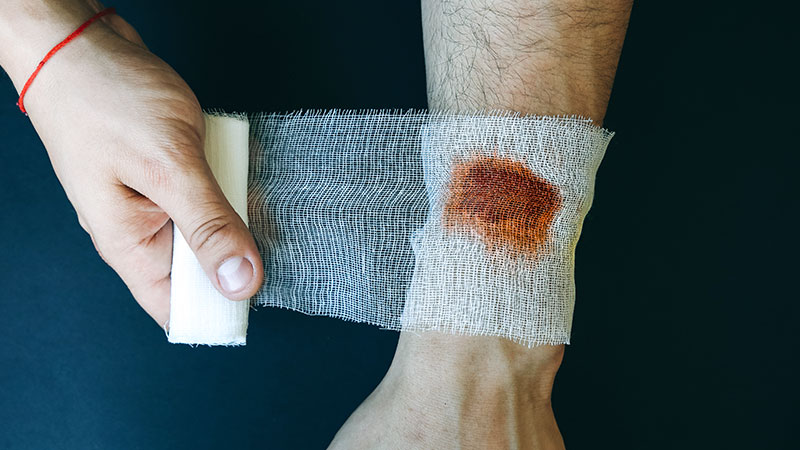 Wound Healing