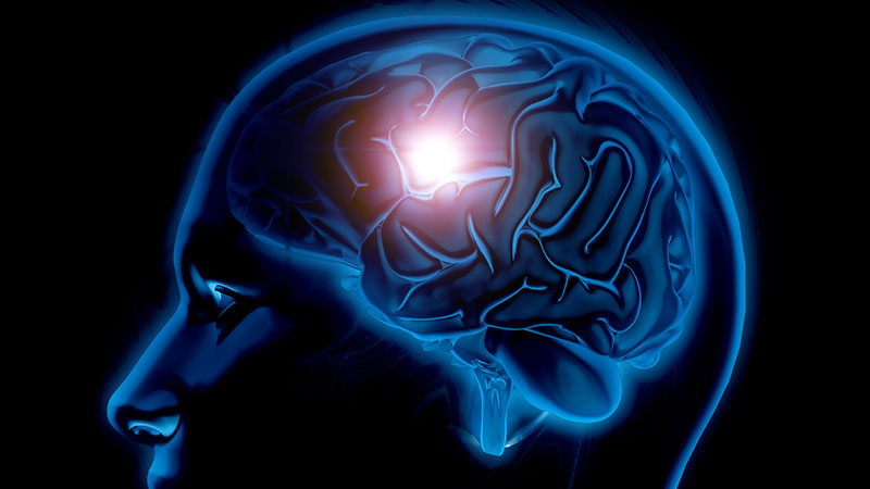 Cognitive Dysfunction