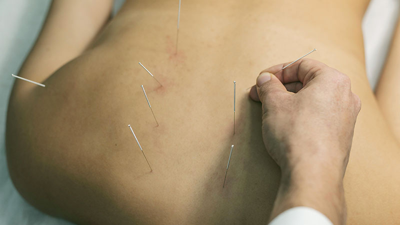 Potential Risks and Side Effects