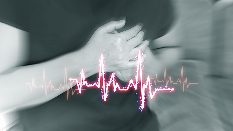 Tachycardia