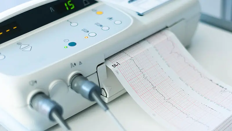 Annual EKG Screening Test