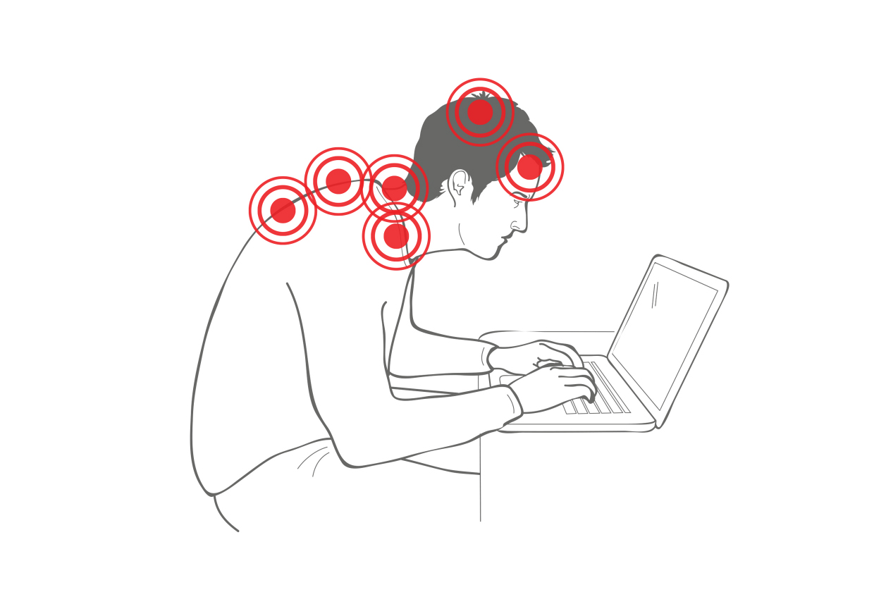 Forward Head Posture