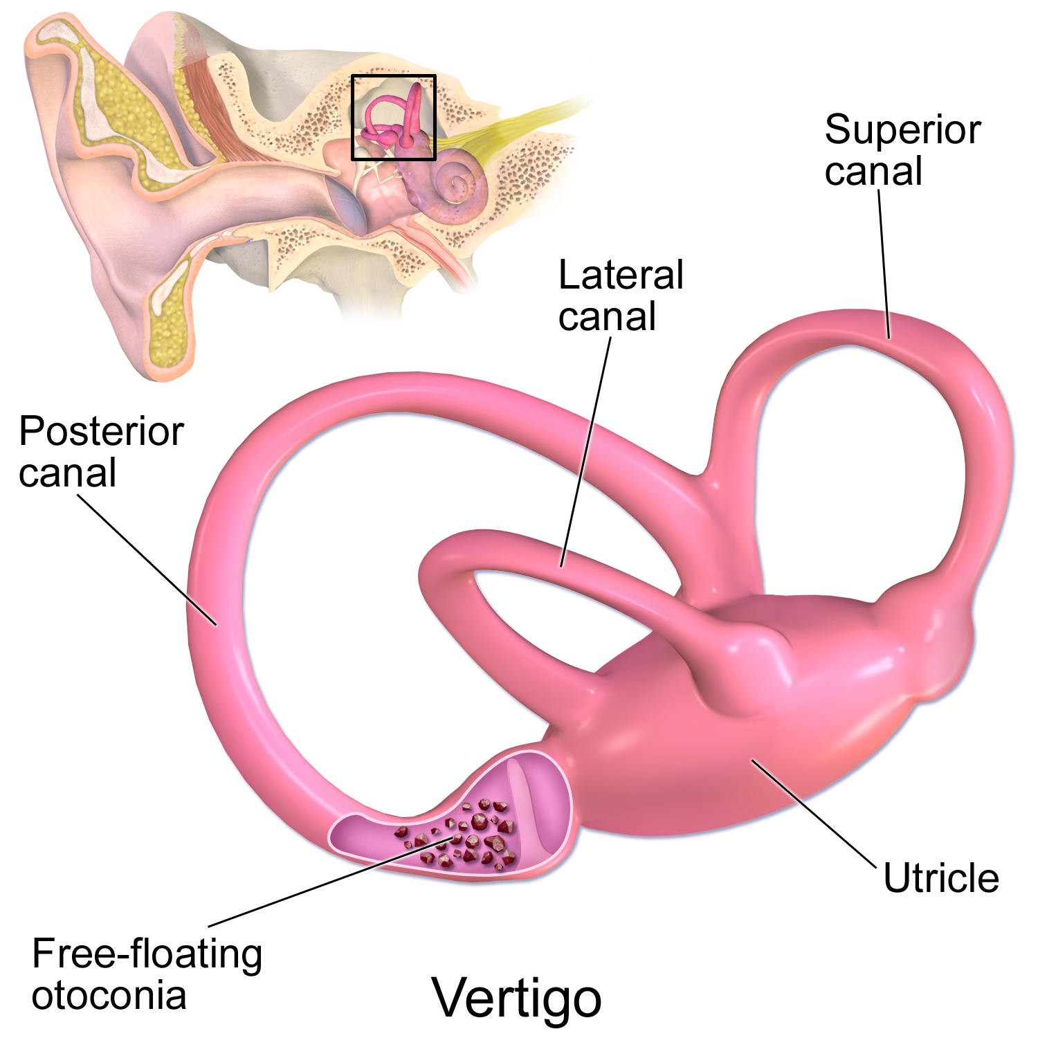 Vestibular System