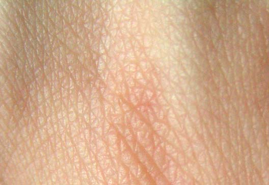 Human Skin