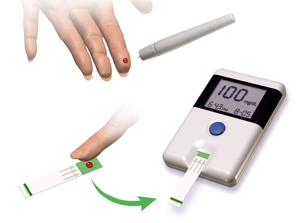 Blood Glucose Testing