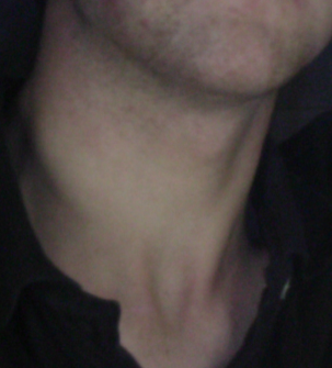 Neck Anatomy